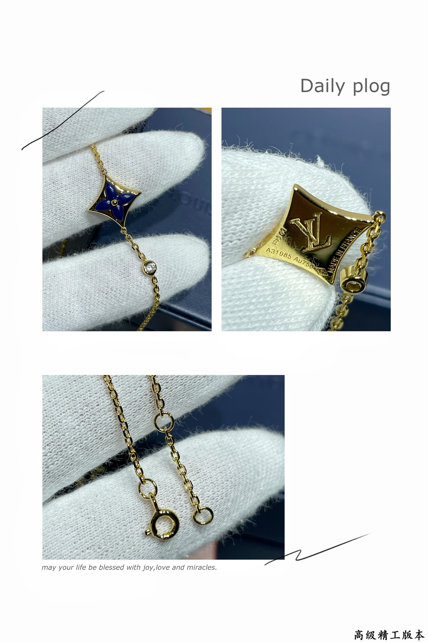 L0vis Vvtt0n Bracelet